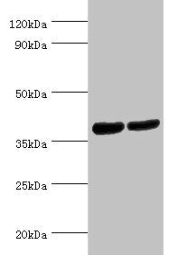 Western blot All lanes: Renin receptor antibody at 2ug/ml Lane 1: Hela whole cell lysate Lane 2: Mouse heart tissue Secondary Goat polyclonal to rabbit IgG at 1/10000 dilution Predicted band size: 40, 36 kDa Observed band size: 40 kDa