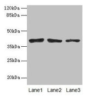 Western blot All lanes: ATP6AP2 antibody at 10µg/ml Lane 1: Mouse eye tissue Lane 2: COLO205 whole cell lysate Lane 3: Hela whole cell lysate Secondary Goat polyclonal to rabbit IgG at 1/10000 dilution Predicted band size: 40, 36 kDa Observed band...