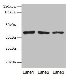 Western blot All lanes: ATP6AP2 antibody at 10µg/ml Lane 1: Mouse eye tissue Lane 2: COLO205 whole cell lysate Lane 3: Hela whole cell lysate Secondary Goat polyclonal to rabbit IgG at 1/10000 dilution Predicted band size: 40, 36 kDa Observed band...