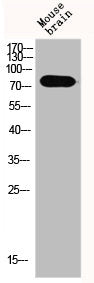 Western Blot analysis of MOuse-brain cells using Epsin 1 Polyclonal Antibody