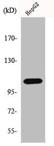 Western Blot analysis of rat lung cells using ERAP1 Polyclonal Antibody