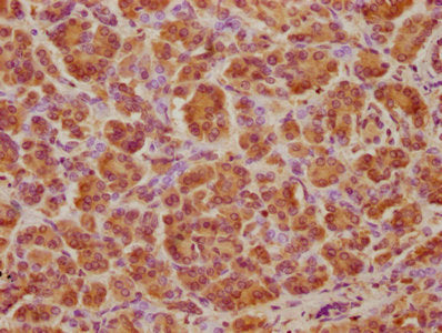 IHC image of CSB-PA002396LA01HU diluted at 1:100 and staining in paraffin-embedded human pancreatic tissue performed on a Leica BondTM system. After dewaxing and hydration, antigen retrieval was mediated by high pressure in a citrate buffer (pH 6....
