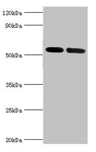 Western blot All lanes: V-type proton ATPase subunit B, kidney isoform antibody at 7ug/ml Lane 1: Mouse kidney tissue Lane 2: 293T whole cell lysate Secondary Goat polyclonal to rabbit IgG at 1/10000 dilution Predicted band size: 57 kDa Observed b...