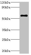 Western blot All lanes: ATP6V1B2 antibody at 5µg/ml + Hela whole cell lysate Secondary Goat polyclonal to rabbit IgG at 1/10000 dilution Predicted band size: 57 kDa Observed band size: 57 kDa