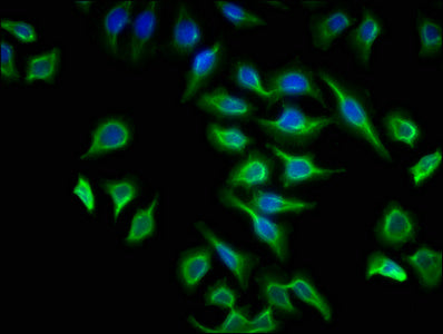 Immunofluorescence staining of A549 cells with CSB-PA002409LA01HU at 1:133, counter-stained with DAPI. The cells were fixed in 4% formaldehyde, permeabilized using 0.2% Triton X-100 and blocked in 10% normal Goat Serum. The cells were then incubat...