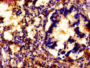 IHC image of CSB-PA863972LA01HU diluted at 1: 500 and staining in paraffin-embedded human lung tissue performed on a Leica BondTM system. After dewaxing and hydration, antigen retrieval was mediated by high pressure in a citrate buffer (pH 6.0) ....