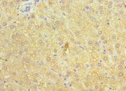Immunohistochemistry of paraffin-embedded human liver tissue using CSB-PA002415ESR2HU at dilution of 1:100