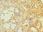 Immunohistochemistry of paraffin-embedded human gallbladder tissue using CSB-PA002438ESR2HU at dilution of 1:100