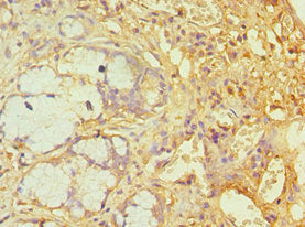 Immunohistochemistry of paraffin-embedded human gallbladder tissue using CSB-PA002438ESR2HU at dilution of 1:100