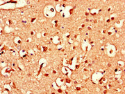 Immunohistochemistry of paraffin-embedded human brain tissue using CSB-PA002440LA01HU at dilution of 1:100