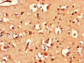Immunohistochemistry of paraffin-embedded human brain tissue using CSB-PA002440LA01HU at dilution of 1:100