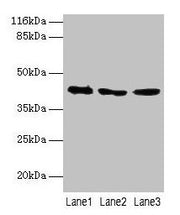 Western blot All lanes: ATXN3 antibody at 2µg/ml Lane 1: 293T whole cell lysate Lane 2: Mouse brain tissue Lane 3: MCF-7 whole cell lysate Secondary Goat polyclonal to rabbit IgG at 1/10000 dilution Predicted band size: 42, 36, 40, 21 kDa Observed...