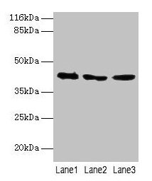 Western blot All lanes: ATXN3 antibody at 2µg/ml Lane 1: 293T whole cell lysate Lane 2: Mouse brain tissue Lane 3: MCF-7 whole cell lysate Secondary Goat polyclonal to rabbit IgG at 1/10000 dilution Predicted band size: 42, 36, 40, 21 kDa Observed...