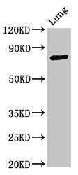 Western Blot Positive WB detected in: Rat lung tissue All lanes: ATXN7 antibody at 3.3ug/ml Secondary Goat polyclonal to rabbit IgG at 1/50000 dilution Predicted band size: 96, 102, 80 kDa Observed band size: 80 kDa