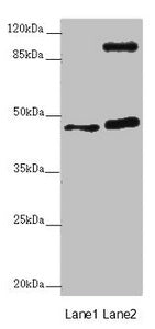 Western blot All lanes: AURKA antibody at 2µg/ml Lane 1: NIH/3T3 whole cell lysate Lane 2: HT29 whole cell lysate Secondary Goat polyclonal to rabbit IgG at 1/10000 dilution Predicted band size: 46 kDa Observed band size: 46, 110 kDa