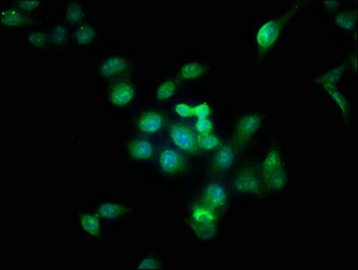Immunofluorescence staining of Hela cells with CSB-PA002458EA01HU at 1:166, counter-stained with DAPI. The cells were fixed in 4% formaldehyde, permeabilized using 0.2% Triton X-100 and blocked in 10% normal Goat Serum. The cells were then incubat...