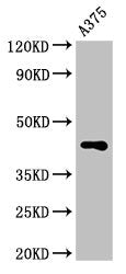Western Blot Positive WB detected in: A375 whole cell lysate All lanes: AURKC antibody at 3.2µg/ml Secondary Goat polyclonal to rabbit IgG at 1/50000 dilution Predicted band size: 36, 33, 34 kDa Observed band size: 45 kDa