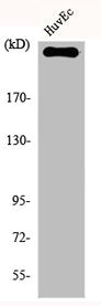 Western Blot analysis of HuvEc cells using Factor VIII Polyclonal Antibody