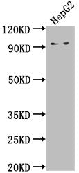 Western Blot Positive WB detected in: HepG2 whole cell lysate All lanes: AVIL antibody at 1:2000 Secondary Goat polyclonal to rabbit IgG at 1/50000 dilution Predicted band size: 93, 92 kDa Observed band size: 93 kDa