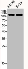 Western Blot analysis of AD293 HELA cells using FAK Polyclonal Antibody