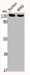 Western Blot analysis of Jurkat K562 cells using FAK Polyclonal Antibody