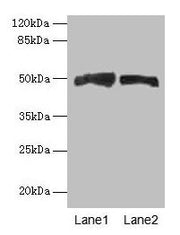 Western blot All lanes: AZIN1 antibody at 4µg/ml Lane 1: Mouse liver tissue Lane 2: PC-3 whole cell lysate Secondary Goat polyclonal to rabbit IgG at 1/10000 dilution Predicted band size: 50 kDa Observed band size: 50 kDa
