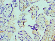 Immunohistochemistry of paraffin-embedded human placenta tissue using CSB-PA002485ESR1HU at dilution of 1:100