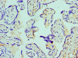 Immunohistochemistry of paraffin-embedded human placenta tissue using CSB-PA002485ESR1HU at dilution of 1:100
