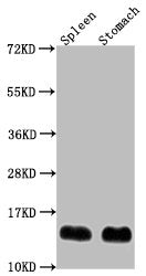 Western Blot Positive WB detected in: Mouse spleen tissue, Mouse stomach tissue All lanes: B2m antibody at 1:2000 Secondary Goat polyclonal to rabbit IgG at 1/50000 dilution Predicted band size: 14 kDa Observed band size: 14 kDa