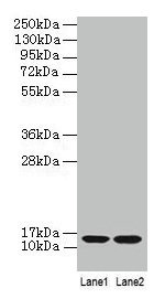 Western blot All lanes: B2M antibody at 2µg/ml Lane 1: A431 whole cell lysate Lane 2: Mouse lung tissue Secondary Goat polyclonal to rabbit IgG at 1/10000 dilution Predicted band size: 14 kDa Observed band size: 14 kDa