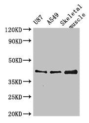Western Blot Positive WB detected in: U87 whole cell lysate, A549 whole cell lysate, Mouse skeletal muscle tissue All lanes: B3GALT4 antibody at 3µg/ml Secondary Goat polyclonal to rabbit IgG at 1/50000 dilution Predicted band size: 42 kDa Observe...