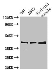 Western Blot Positive WB detected in: U87 whole cell lysate, A549 whole cell lysate, Mouse skeletal muscle tissue All lanes: B3GALT4 antibody at 3µg/ml Secondary Goat polyclonal to rabbit IgG at 1/50000 dilution Predicted band size: 42 kDa Observe...