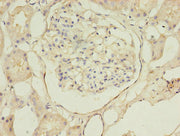 Immunohistochemistry of paraffin-embedded human kidney tissue using CSB-PA002499EA01HU at dilution of 1:100