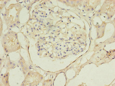Immunohistochemistry of paraffin-embedded human kidney tissue using CSB-PA002499EA01HU at dilution of 1:100