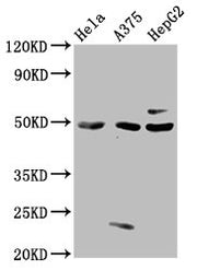 Western Blot Positive WB detected in: Hela whole cell lysate, A375 whole cell lysate, HepG2 whole cell lysate All lanes: STK24 antibody at 3µg/ml Secondary Goat polyclonal to rabbit IgG at 1/50000 dilution Predicted band size: 50, 48 kDa Observed...