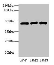 Western blot All lanes: B3GNT2 antibody at 4µg/ml Lane 1: 293T whole cell lysate Lane 2: Jurkat whole cell lysate Lane 3: HL60 whole cell lysate Secondary Goat polyclonal to rabbit IgG at 1/10000 dilution Predicted band size: 47, 46 kDa Observed b...