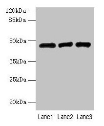 Western blot All lanes: B3GNT2 antibody at 4µg/ml Lane 1: 293T whole cell lysate Lane 2: Jurkat whole cell lysate Lane 3: HL60 whole cell lysate Secondary Goat polyclonal to rabbit IgG at 1/10000 dilution Predicted band size: 47, 46 kDa Observed b...