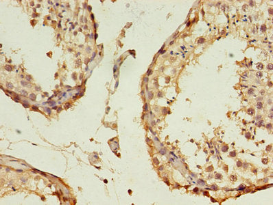 Immunohistochemistry of paraffin-embedded human testis tissue using CSB-PA002503EA01HU at dilution of 1:100