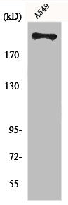 Western Blot analysis of A549 cells using Fatty Acid Synthase Polyclonal Antibody