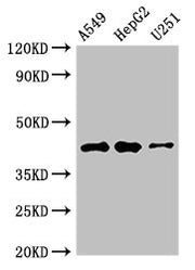 Western Blot Positive WB detected in: A549 whole cell lysate, HepG2 whole cell lysate, U251 whole cell lysate All lanes: B4GALT2 antibody at 3.5µg/ml Secondary Goat polyclonal to rabbit IgG at 1/50000 dilution Predicted band size: 42, 35, 45 kDa O...