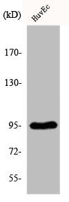Western Blot analysis of HuvEc cells using Fes Polyclonal Antibody