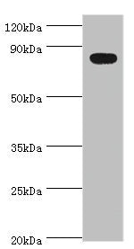 Western blot All lanes: BACH1 antibody at 2ug/ml + Mouse thymus tissue Secondary Goat polyclonal to rabbit IgG at 1/10000 dilution Predicted band size: 82 kDa Observed band size: 82 kDa