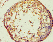 Immunohistochemistry of paraffin-embedded human testis tissue using CSB-PA002526ESR2HU at dilution of 1:100