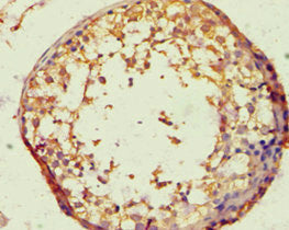 Immunohistochemistry of paraffin-embedded human testis tissue using CSB-PA002526ESR2HU at dilution of 1:100