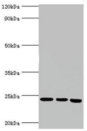 Western blot All lanes: BAG family molecular chaperone regulator 2 antibody at 6ug/ml Lane 1: Jurkat whole cell lysate Lane 2: Hela whole cell lysate Lane 3: HepG2 whole cell lysate Secondary Goat polyclonal to rabbit IgG at 1/10000 dilution Predi...