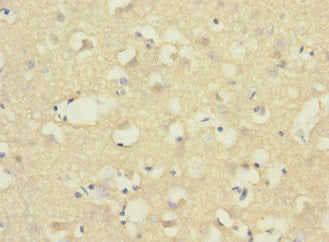 Immunohistochemistry of paraffin-embedded human brain tissue using CSB-PA002541ESR1HU at dilution of 1:100
