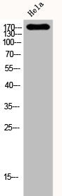 Western Blot analysis of Hela cells using Flk-1 Polyclonal Antibody