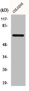 Western Blot analysis of COLO205 cells using FoxO4 Polyclonal Antibody