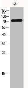 Western Blot analysis of KB cells using FSHR Polyclonal Antibody