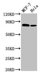 Western Blot Positive WB detected in: MCF-7 whole cell lysate, Hela whole cell lysate All lanes: BCAR1 antibody at 3.4µg/ml Secondary Goat polyclonal to rabbit IgG at 1/50000 dilution Predicted band size: 94, 96, 78, 98 kDa Observed band size: 78 kDa
